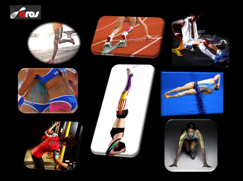 Використання кінезіотейпів в спорті Використання кінезіотейпів в спорті